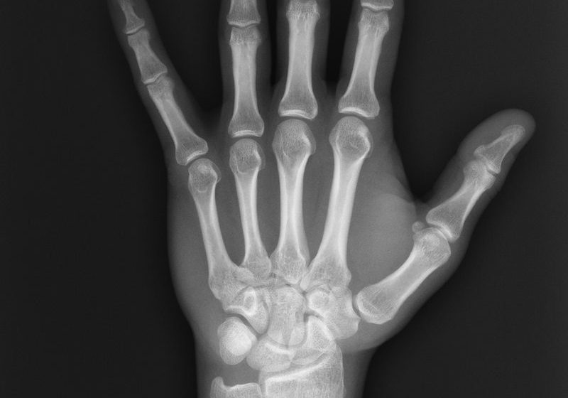 the-history-of-x-ray-technology